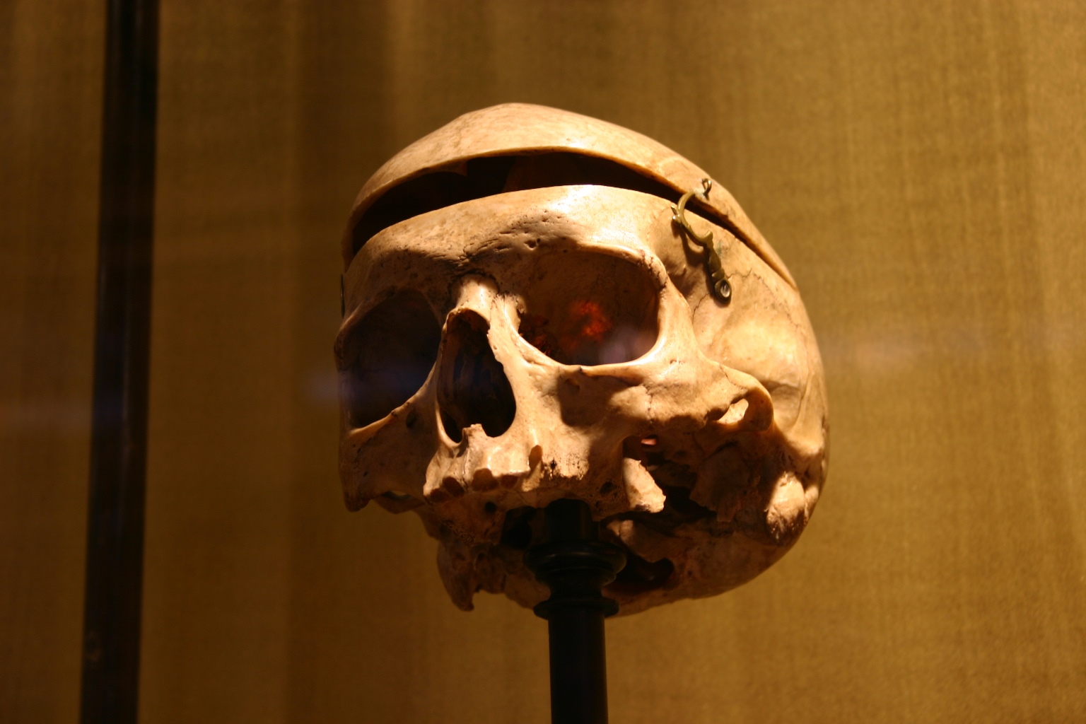 Philippe Pinel demonstration skull, Musée d'Histoire de la Médecine, Paris (35).JPG